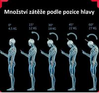 fyzioterapie Krystofova_hlava_cislo_5